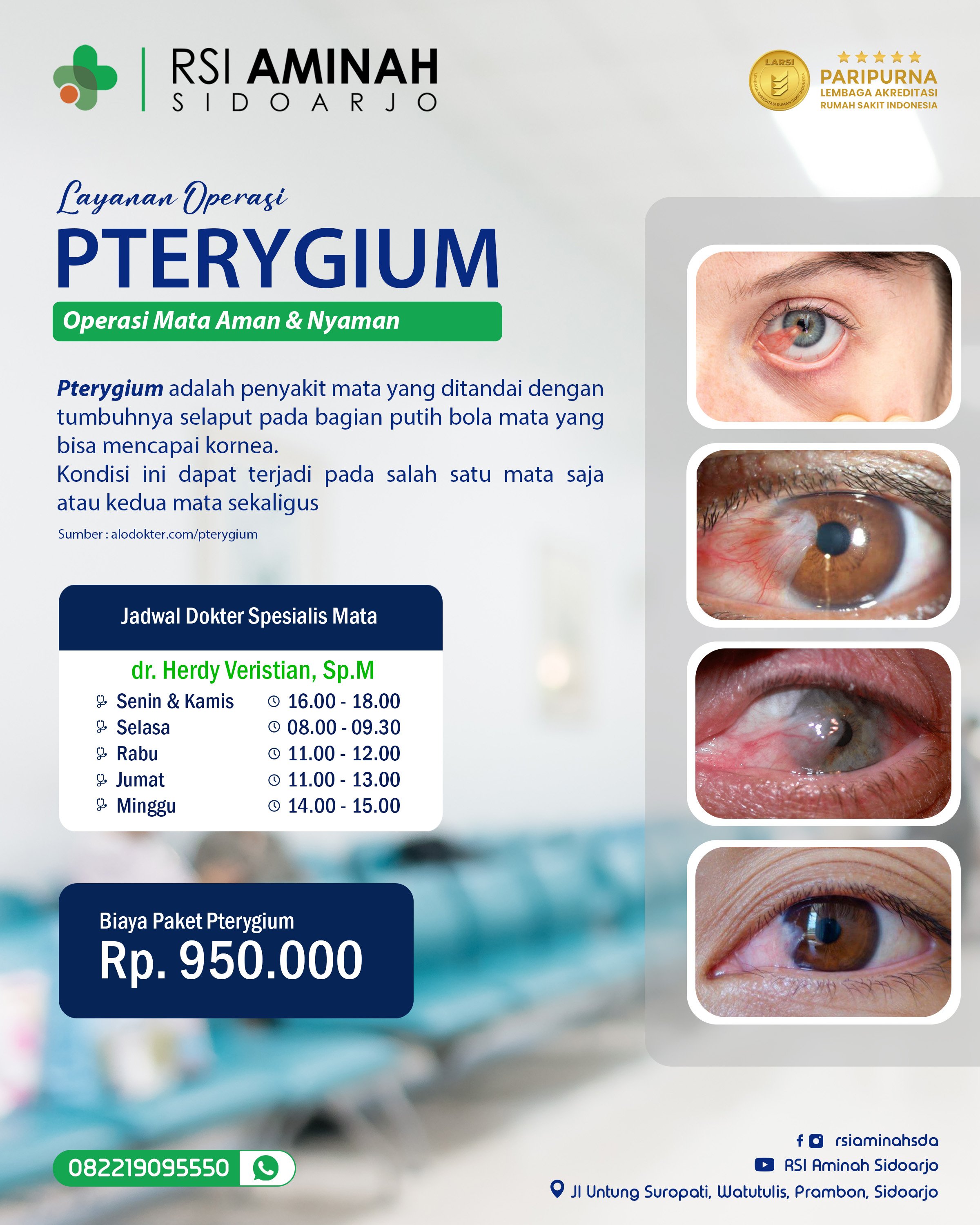 Operasi Pterygium RSI Aminah Sidoarjo